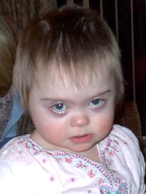 Bryony